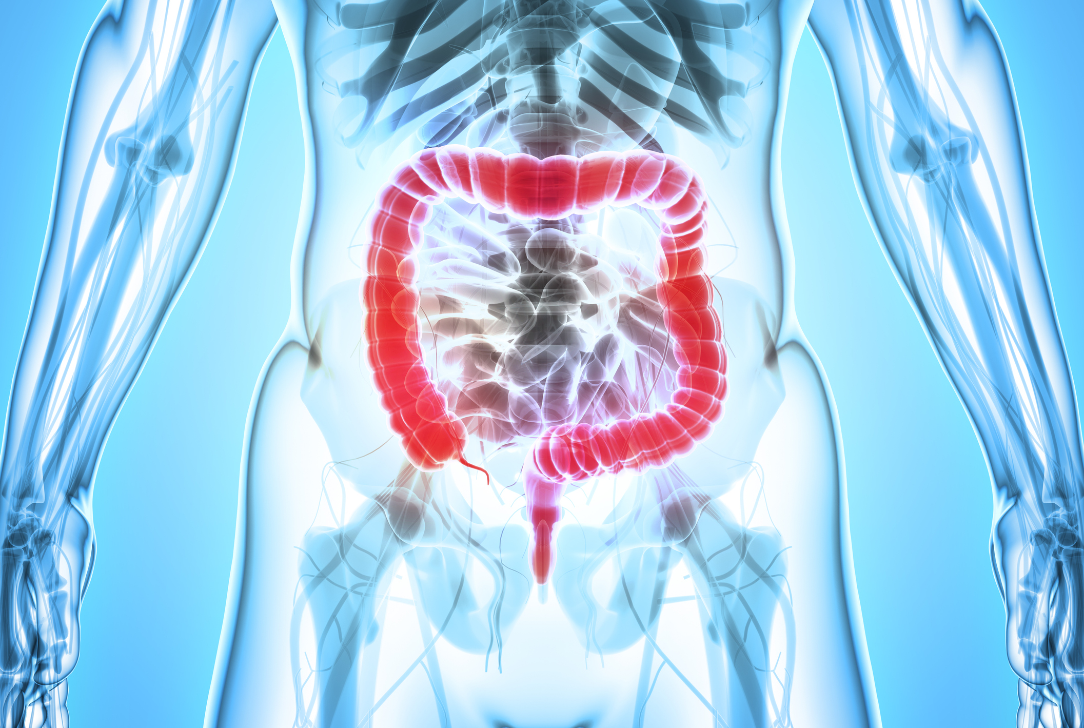 colon-and-rectum-surgically-treating-tumors-and-polyps-is-increasingly